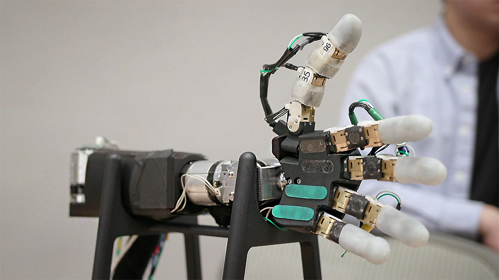 Smart Prosthetics: Anggota Tubuh Bionik yang Semakin Canggih